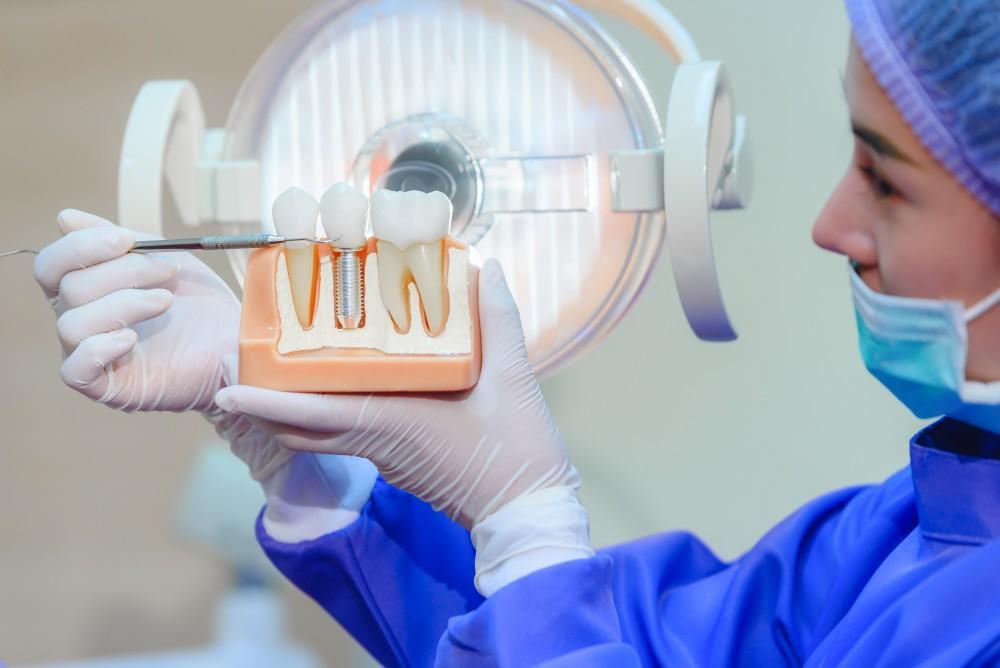 Top 5 Dental Cements for Crown & Bridges Top 5 Dental Cements for Crown & Bridges